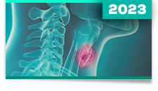 Carcinoma de tireoide: medular