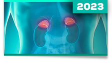 Carcinomas da Adrenal, Feocromocitomas e Paragangliomas