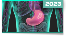 Carcinomas neuroendócrinos extrapulmonares