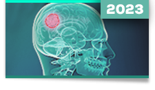 Gliomas