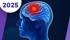 Gliomas